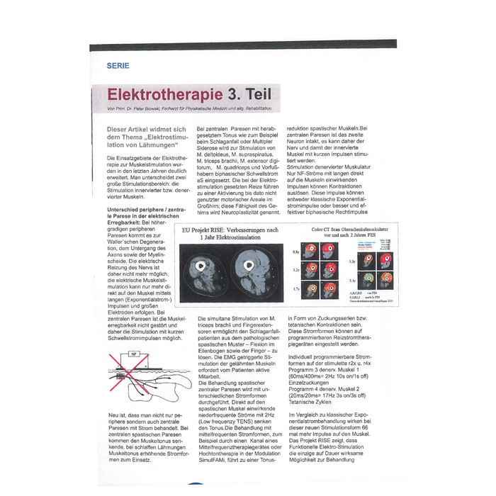 Fachartikel: MTF-News Fortbildung: „Elektrotherapie Teil 3“